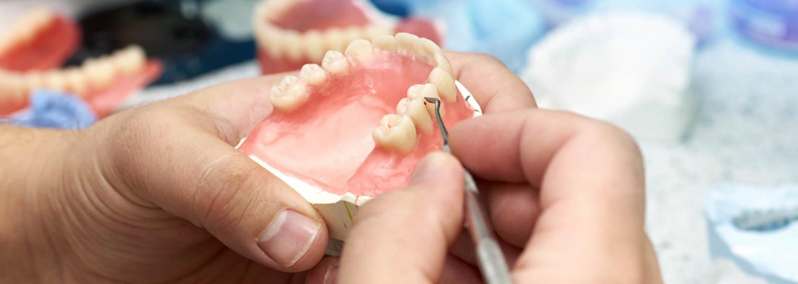 denture repairs